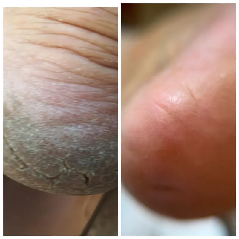 online course καλλωπιστικό pedicure online course καλλωπιστικό pedicure