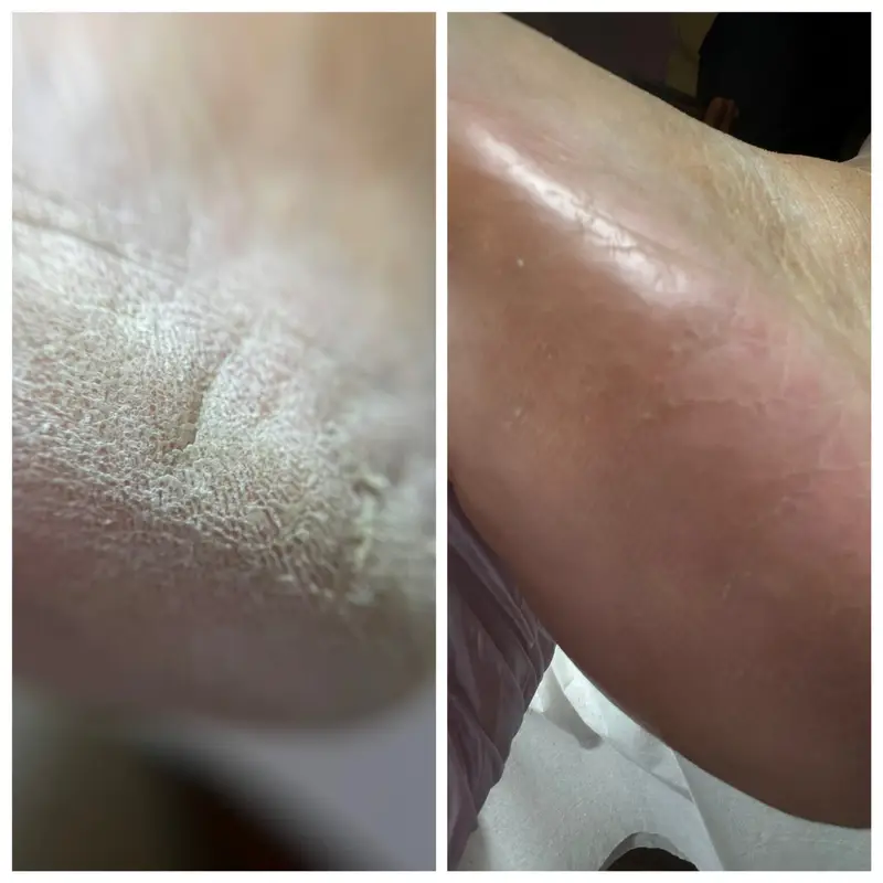 online course καλλωπιστικό pedicure online course καλλωπιστικό pedicure